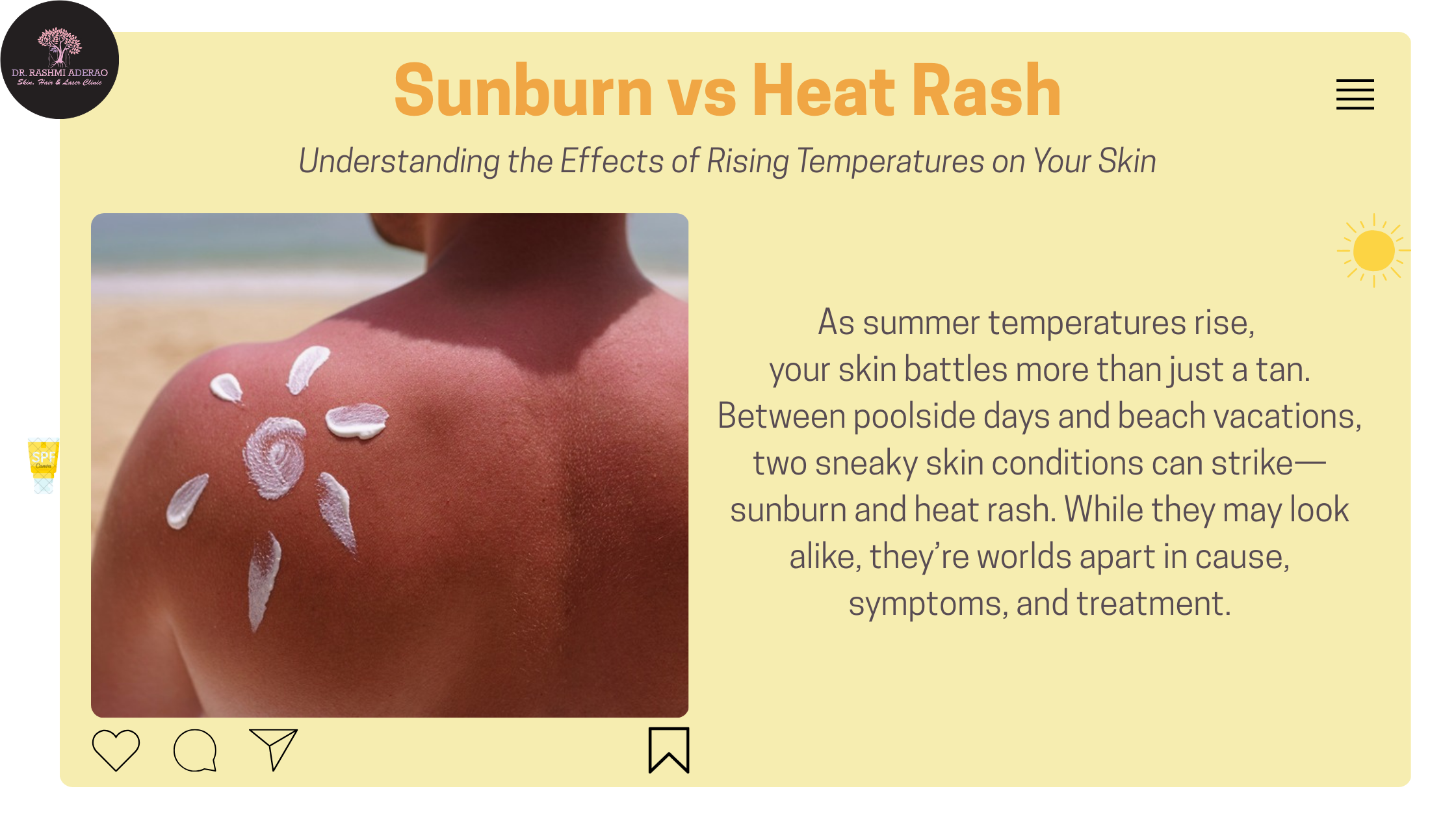 Sunburn vs Heat Rash: Understanding the Effects of Rising Temperatures on Your Skin
