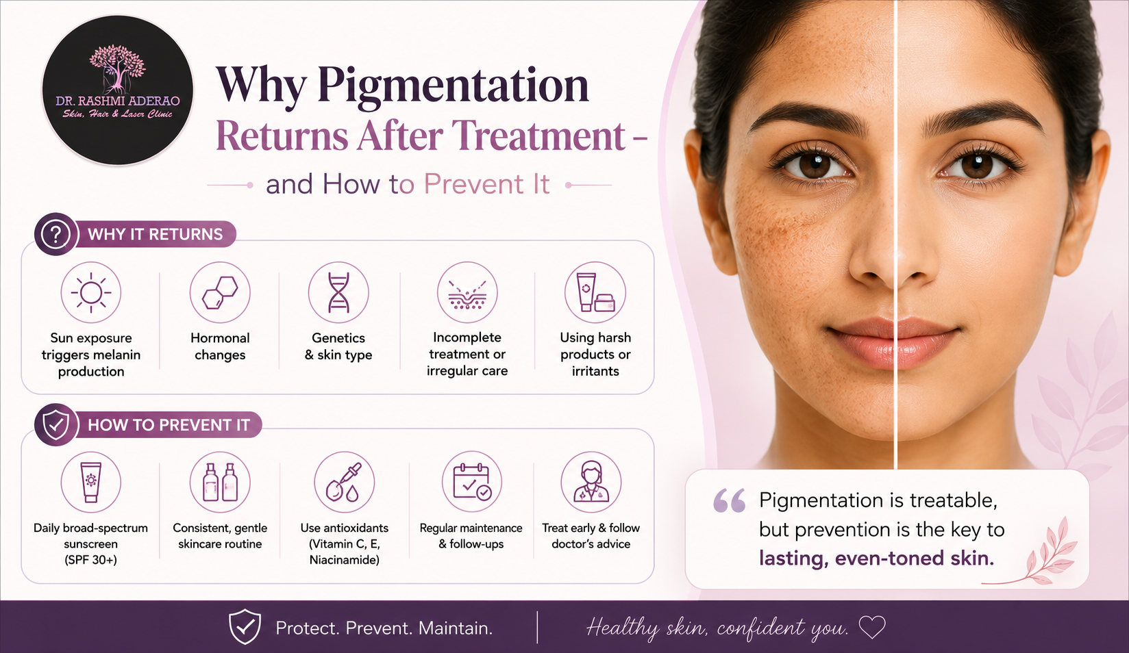 Why Pigmentation Returns After Treatment – and How to Prevent It